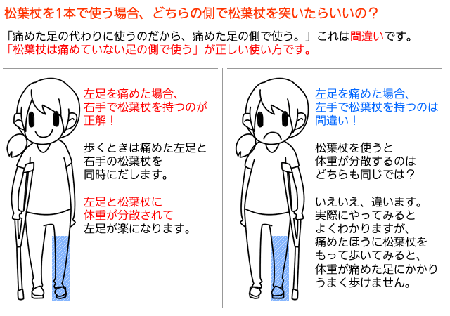 松葉杖は痛めていない足の側でつかう。痛めた足と、松葉杖に体重が分散されて、痛めた足が楽になります。