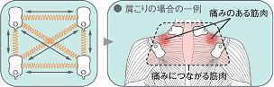 �ŵ����Ŵ� EW6021������