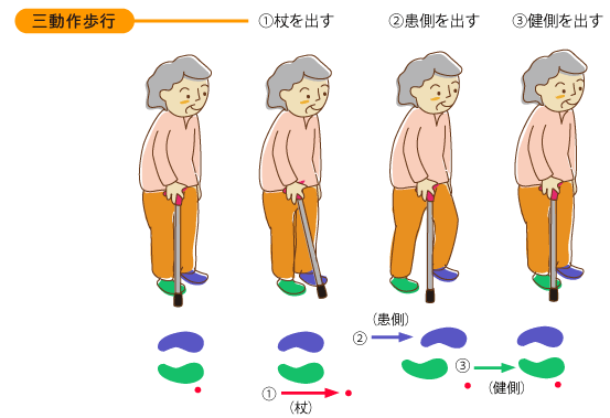 ロフストランドクラッチの三動作歩行