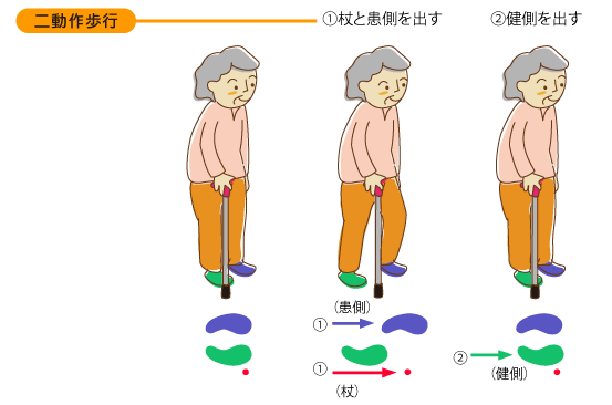 ロフストランドクラッチの二動作歩行