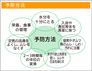 床ずれの予防方法