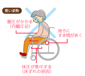 車椅子の悪い姿勢