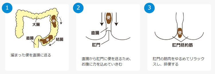 トイレでふんばる君Z(在宅向け) 便座での自立的排泄を補助|トイレ