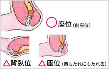 前傾姿勢で排便もスムーズに