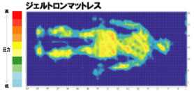 ジェルトロンの説明