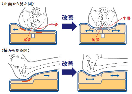 >車いす用クッション レスポ MRSPNV/MRSPORの説明