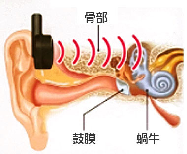 きくぞうくん3 ES-KZ3 骨伝導助聴器の説明