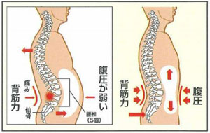 腰痛とは？