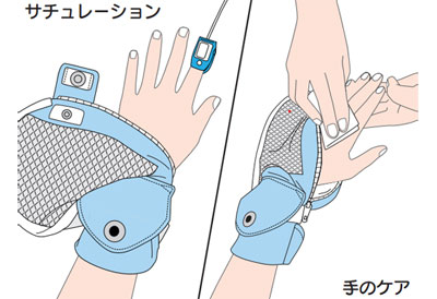 フドーてぶくろ（フドー手袋） 横入れタイプ 自傷防止手袋・介護ミトン（手袋）の説明
