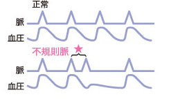 不規則脈波頻度（％IHB）表示02