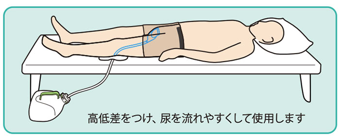 男性用集尿器 ダンディユリナーの説明