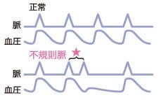 上腕式血圧計 UA-651Plusのの説明
