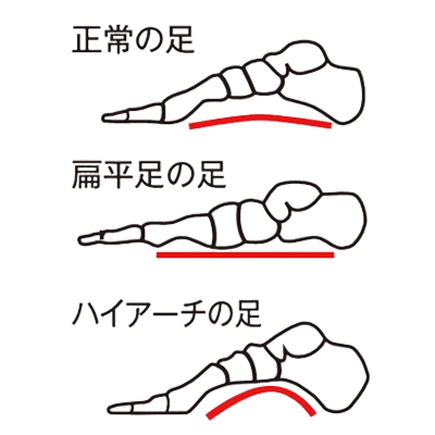  サポーター ソルボ タテアーチサポーター薄型(両足入) 三進興産 扁平足･ハイアーチ対応 土ふまず形成 介護サポーター 歩行補助の説明